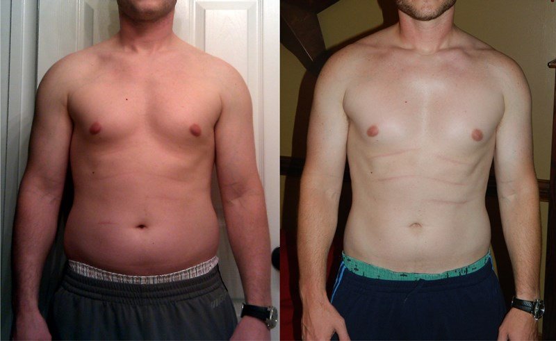 Dieta-cetogenica-antes-e-depois-01
